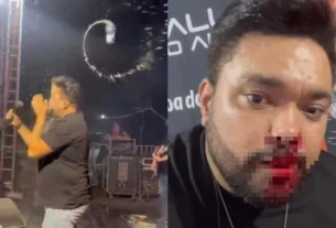 Cantor é atingido por lata no rosto e sai do show sangrando em MT