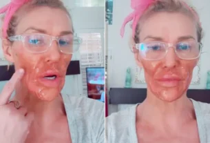 Ex-modelo-modelo Brandi Glanville Mostra Novo Rosto APÓs Iniciar Tratamento