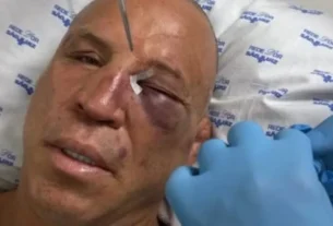 Com olho roxo, Wanderlei recebe alta após nocaute em pancadaria