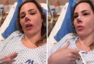 JU ISEN PASSA PELA 3ª CIRURGIA NO ROSTO APÓS ATAQUE DE CACHORRO