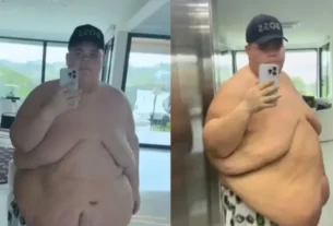 Gordão da XJ Comemora Após Perder 115 kg