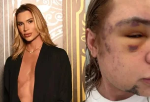 Influenciador Júnior Dutra Morre Após Procedimento